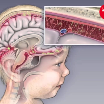 ЦАХИЛГААН МЕНИНГИТИЙН ЭРСДЭЛ ӨНДӨР УЛИРАЛ ЭХЭЛЖ БАЙНА