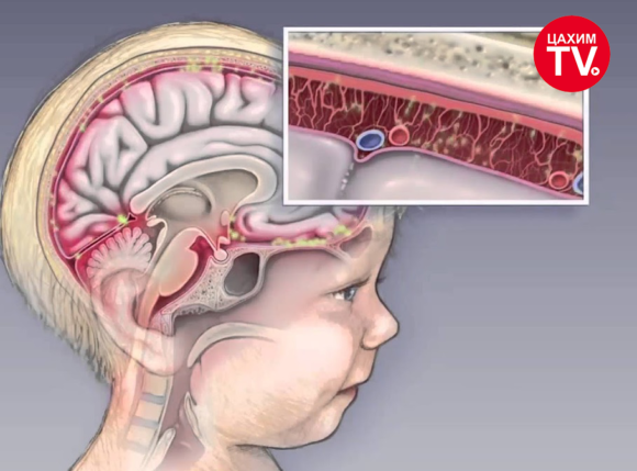 ЦАХИЛГААН МЕНИНГИТИЙН ЭРСДЭЛ ӨНДӨР УЛИРАЛ ЭХЭЛЖ БАЙНА